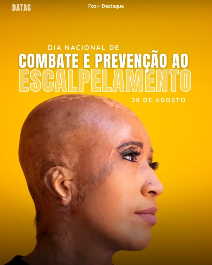 Dia Nacional de Combate e Prevenção ao Escalpelamento
Datas 28 de Agosto 2024 Foz em Destaque